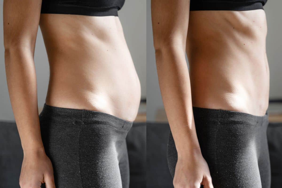 Post-Pregnancy: What Happens to Your Abdominal Muscles After Birth Hackney Wick