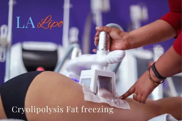 women getting fat freezing Hackney Wick