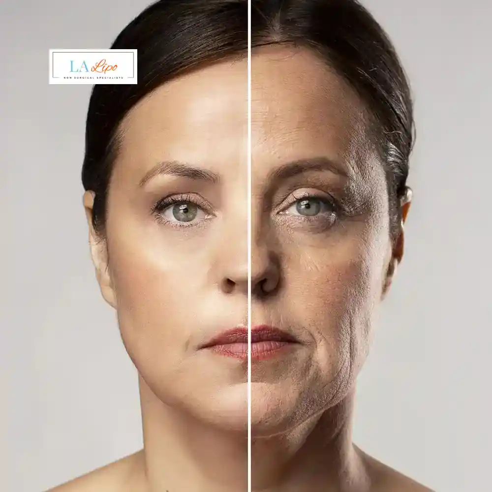 How Can You Tell If Non-Surgical Skin Tightening Is Right for You Hackney Wick?